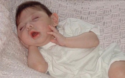 Cô bé sinh ra không có não bây giờ ra sao?