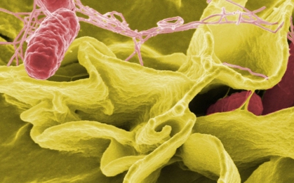 Vi khuẩn Salmonella gây ngộ độc thực phẩm nguy hiểm thế nào?