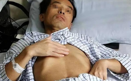 Người đàn ông 53 tuổi mắc ung thư gan, bác sĩ tức giận: Đừng làm việc này quá 3 lần 1 tháng