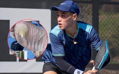 Xót xa bàn chân phồng rộp của Trương Vinh Hiển