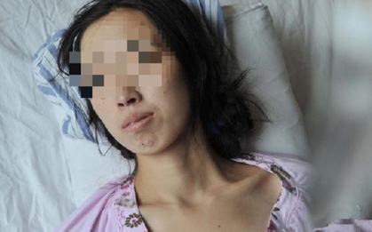 Đi khám vì khó tiêu, người phụ nữ phát hiện ung thư gan: BS hoảng hốt: "Ai lại ăn sáng kiểu này suốt 20 năm?"