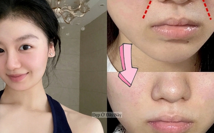 Trẻ hơn 5 tuổi nhờ 5 mẹo cải thiện rãnh cười đơn giản tại nhà