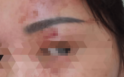 Người phụ nữ bỏng giác mạc vì làm 1 việc khi giặt đồ