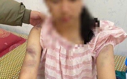 Mẹ bé gái bị bạo hành ở Thái Nguyên: Con bị đánh suốt 4 tiếng, dọa rút móng tay