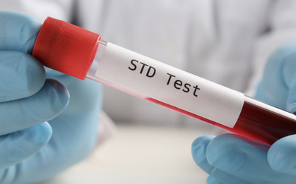 1 bệnh viện ở TP HCM ghi nhận 1 năm hơn 38.000 ca sùi mào gà