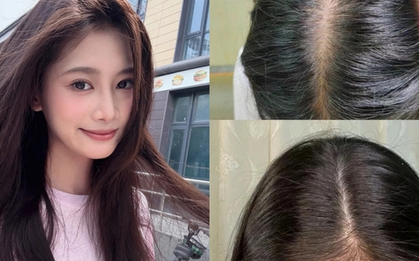 5 xịt mọc tóc "made in Vietnam" để tóc chắc khỏe từ gốc, không lo gãy rụng