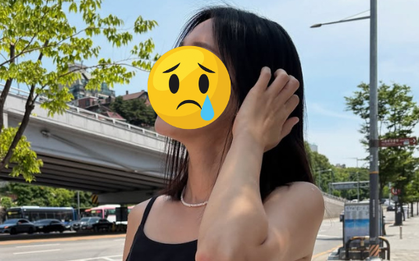 Mỹ nhân phim giờ vàng liều lĩnh "dao kéo" thu ngắn nhân trung, giờ gánh di chứng đến suốt đời