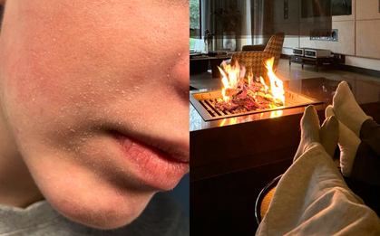 5 thói quen hại da bạn cần bỏ ngay khi trời lạnh, nhất là phụ nữ U40