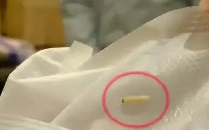 Một thương hiệu băng vệ sinh bị bóc mẽ sản phẩm có chứa “sâu sống bò lúc nhúc”