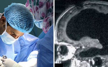 Bí ẩn về người đàn ông mất 90% não, nhưng vẫn có thể sống một cuộc sống bình thường