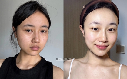 Tôi không skincare cầu kỳ, chỉ ngủ sớm và dưỡng dầu là làn da đã lột xác ngoạn mục!