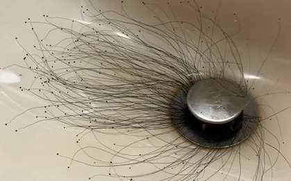 Người đàn ông sốc nặng khi thấy thứ đáng sợ mọc ra từ bồn rửa mặt