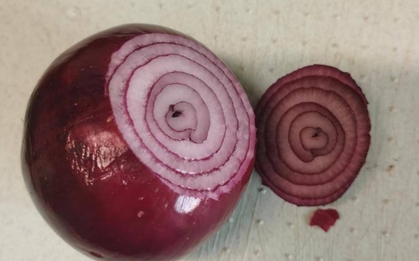 Hành tây có 4 công dụng thần kỳ, ai không biết thì rất thiệt