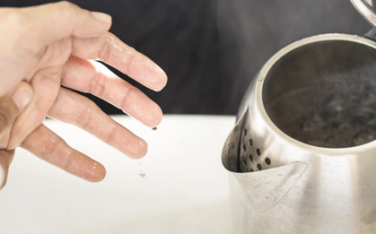 Bé 9 tháng tuổi bỏng 30% cơ thể do kéo dây nguồn ấm siêu tốc