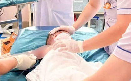 Bé trai tập đi bị bỏng toàn thân từ sơ sẩy "chết người" của người lớn