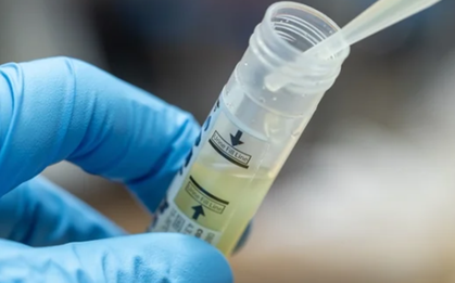 Infographic: Bệnh lây truyền qua đường tình dục có những dấu hiệu nào?