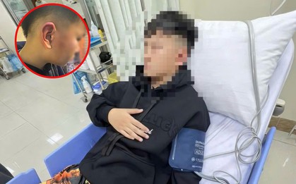 Hà Nội: Bé trai 12 tuổi nghi bị bố của bạn tát, đánh đến choáng váng, hé lộ nguồn cơn