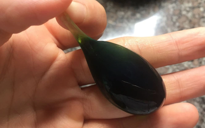 Người đàn ông 38 tuổi suýt chết vì nuốt mật cá trắm để "tăng cường sinh lực"