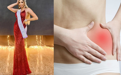 Hoa hậu 28 tuổi qua đời vì ung thư cổ tử cung: BS cảnh báo bệnh đang trẻ hóa, có dấu hiệu này phải đi khám