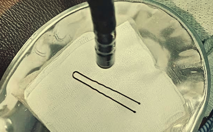 Bé gái 4 tuổi đột ngột khóc thét, vào viện bác sĩ gắp ra thứ "đáng sợ" bên trong