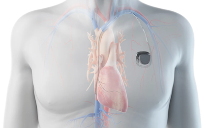 Chàng trai ở TPHCM mắc bệnh hiếm, 100.000 người chỉ có 2 người mắc