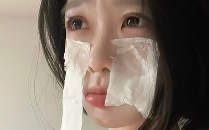 5 thứ KHÔNG BAO GIỜ được bôi lên mặt vì tàn phá làn da: Bất ngờ khi nhiều chị em tưởng đó là mẹo làm đẹp