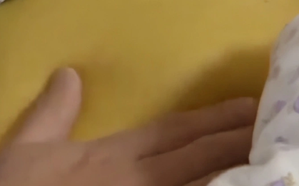 Nữ sinh 20 tuổi suy gan, da vàng như nghệ vì chăm da theo cách của nhiều người