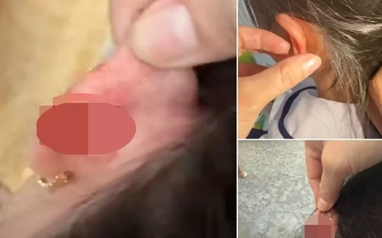 Xác minh vụ giáo viên tiểu học véo tai học sinh lớp 1 chảy máu ở Phú Quốc