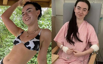 "Bác sĩ nói tôi chỉ còn 48 giờ để sống" - Cô gái 25 tuổi không ngờ mình suýt mất mạng vì bỏ qua những dấu hiệu tưởng bình thường