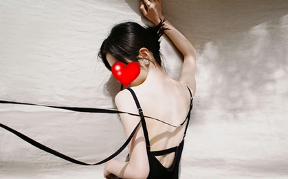 Sao nữ gen Z lộ vết bầm bất thường trên ngực và cánh tay