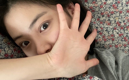 4 bất thường cho thấy cơ thể chị em tích tụ đầy độc tố, bác sĩ khuyên: Ăn 4 thứ và làm 3 việc