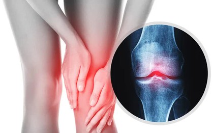 Trời lạnh, đau cơ xương khớp tăng: Chủ động chăm sóc để giảm đau