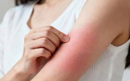 Đừng đợi đến khi phù nề mới đi khám! Bác sĩ chỉ ra 3 dấu hiệu sớm của bệnh thận mà 90% người bỏ qua