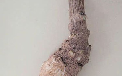 Cảnh báo ngộ độc, phản vệ nguy hiểm từ thực phẩm, rượu ngâm