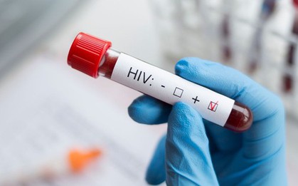 Đi khám sức khỏe định kỳ, nam shipper 35 tuổi phát hiện nhiễm HIV: Choáng váng khi biết nguồn lây