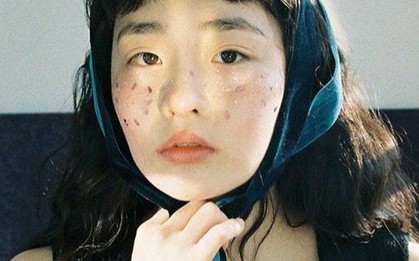 7 vị trí trên cơ thể thường chuyển sang MÀU ĐEN khi ung thư xuất hiện, tự kiểm tra ngay!