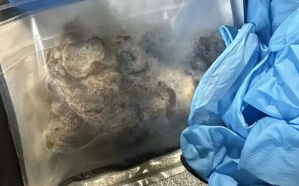 Nam sinh 17 tuổi nguy kịch, phải cắt một phần phổi vì thói quen "gây nghiện" của giới trẻ