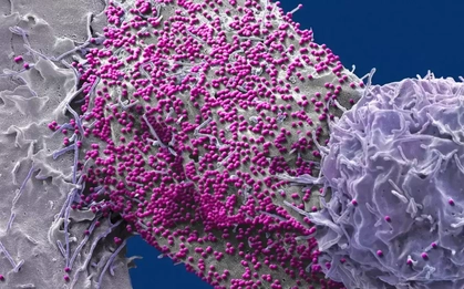 Người đàn ông được chữa khỏi HIV sau khi ghép tế bào gốc