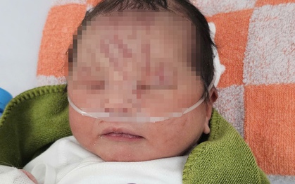 NÓNG: Một trẻ sơ sinh nghi bị "chôn sống" tại vườn cao su