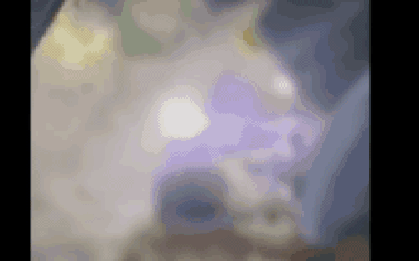 CLIP: Thời khắc bé sơ sinh nghi bị "chôn sống" được cứu