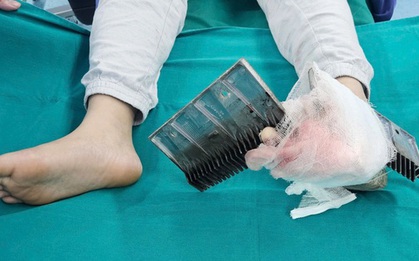 Bé trai bị kẹp chân vào thang cuốn trung tâm thương mại