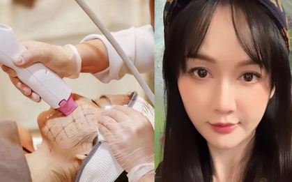 Dâu hào môn bị lệch mặt, sưng phù nguyên 1 tháng vì đi “là phẳng nếp nhăn”