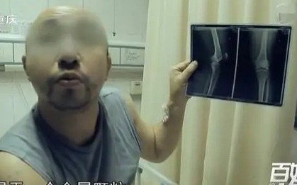 Nửa đêm đau nhói ở gối, người đàn ông phải nhập viện liền được bác sĩ yêu cầu: Gọi cảnh sát ngay lập tức!