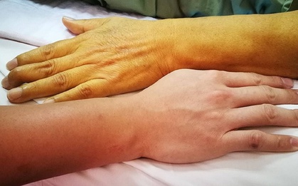 Hai thói quen của nam giới vào buổi sáng gây hại gan hơn cả uống rượu