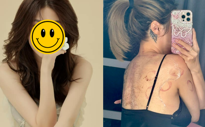 Sao nữ Vbiz đang điều trị trầm cảm: Cập nhật tình hình sức khỏe đáng chú ý