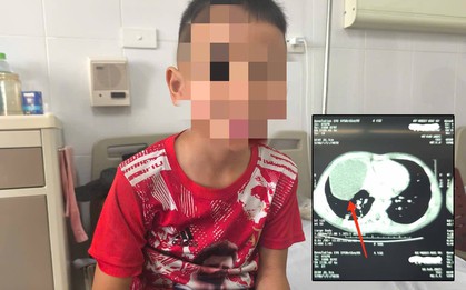 Hà Nội: Con trai bị bạn xô ngã, bố mẹ đưa đi khám và không tin nổi vào ảnh CT