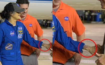 1 chi tiết trên cổ tay nữ phi hành gia NASA khi vừa trở lại trái đất khiến giới y khoa ngỡ ngàng: Điều gì đã xảy ra sau 9 tháng?