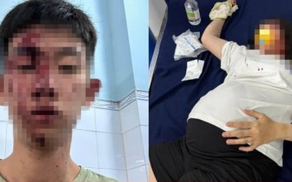 Công an vào cuộc vụ 'người phụ nữ mang bầu 8 tháng bị hành hung ở Đồng Nai'