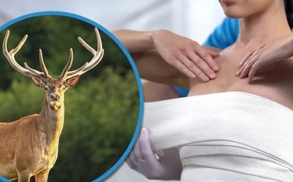 Bị lừa nâng ngực bằng collagen gia súc, cô gái biến dạng ngực, tốn 8,4 tỷ đồng
