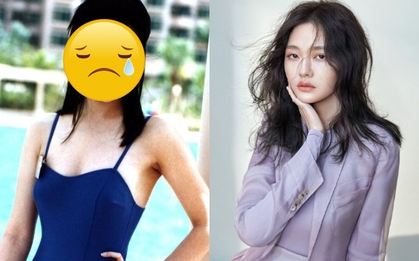 1 Hoa hậu hàng đầu bị cúm và viêm phổi giống Từ Hy Viên, rơi vào tình trạng nguy hiểm chỉ sau 2 ngày phát bệnh